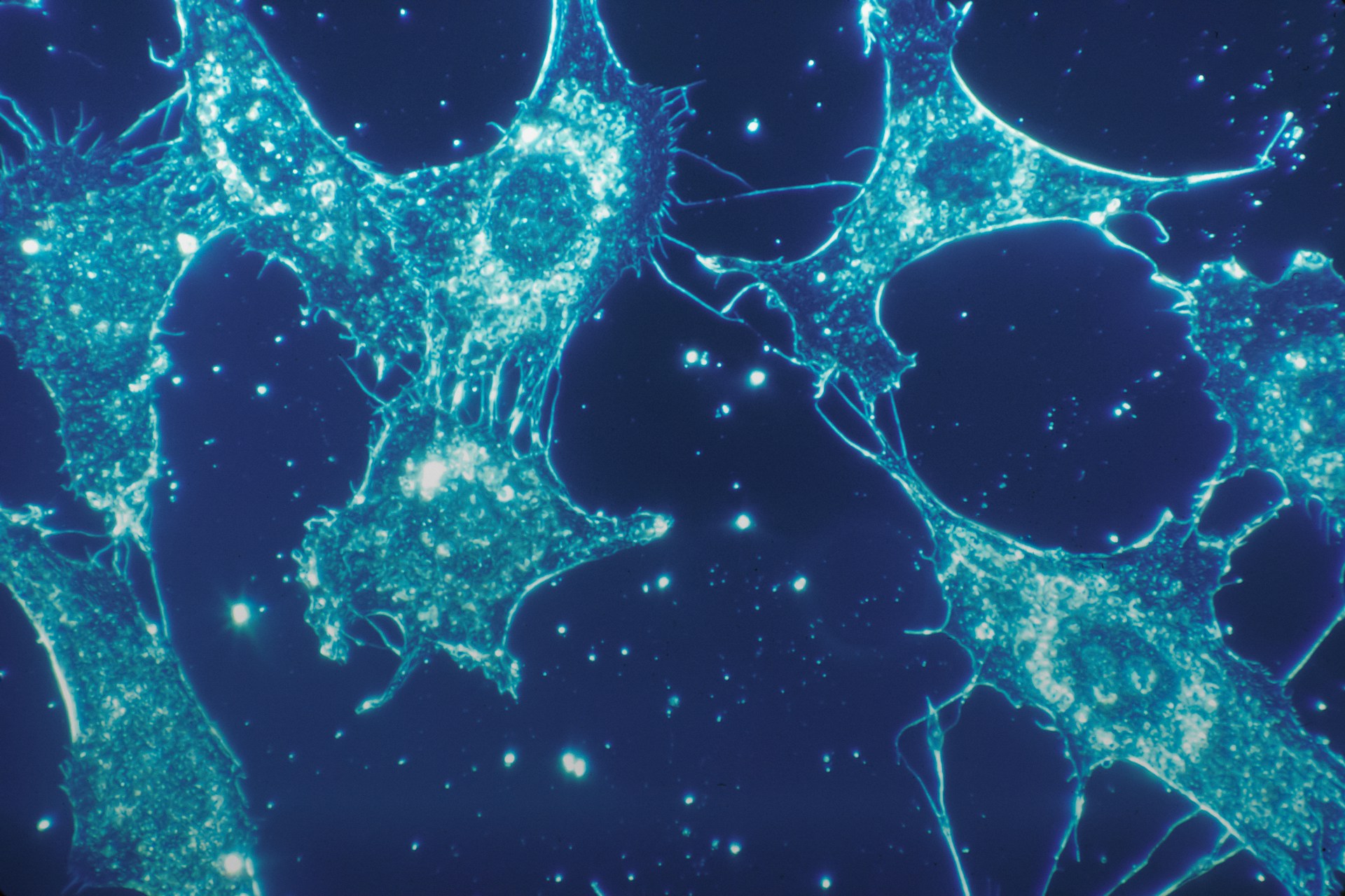 Fluorescence micrograph: cyan-stained cultured cells spread flat across a deep blue field, their edges drawn out into fine branching processes